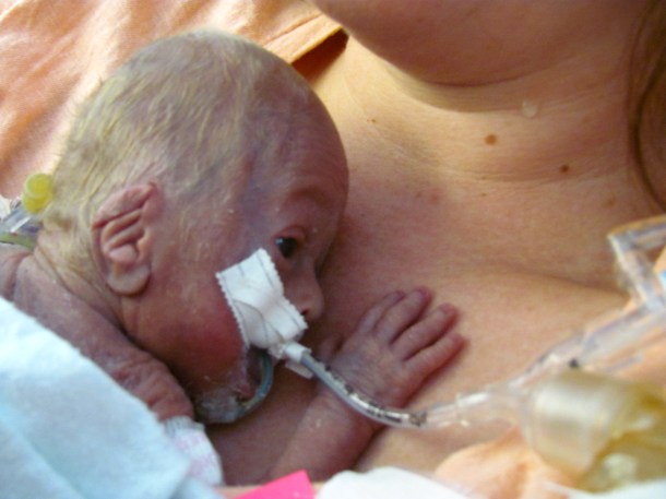 Such an amazing feeling to have your baby placed on your skin for the first time.