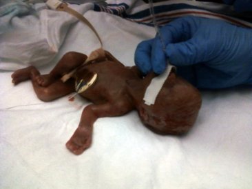 This was the first time Dad saw James. He was seven minutes old.