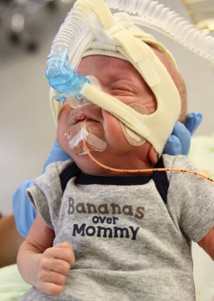 One of my favorite photos from the NICU.